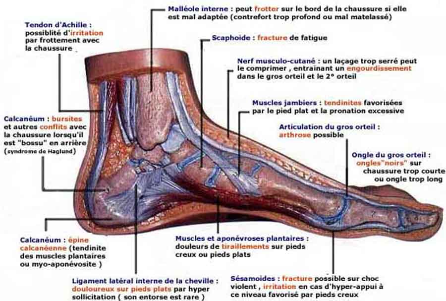 blessures et douleur les plus fréquentes au pied provoquées par la pratique sportive