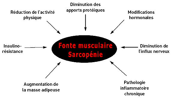 origines de la fonte musculaire ou sarcopénie