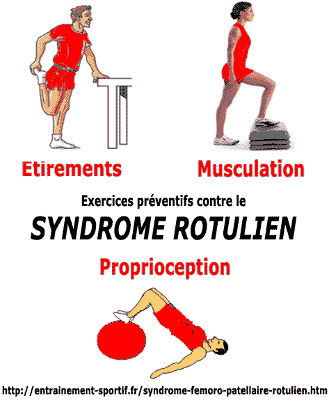 exercices préventifs contre le syndrome rotulien